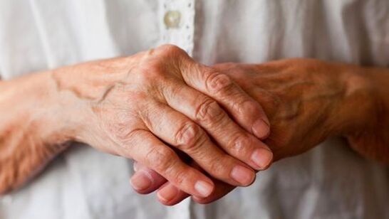 rheumatoid arthritis as a cause of pain in finger joints