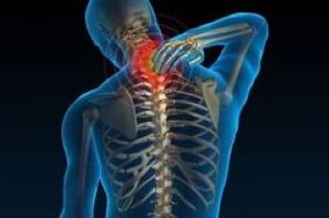 cervical osteochondrosis leads to neck pain